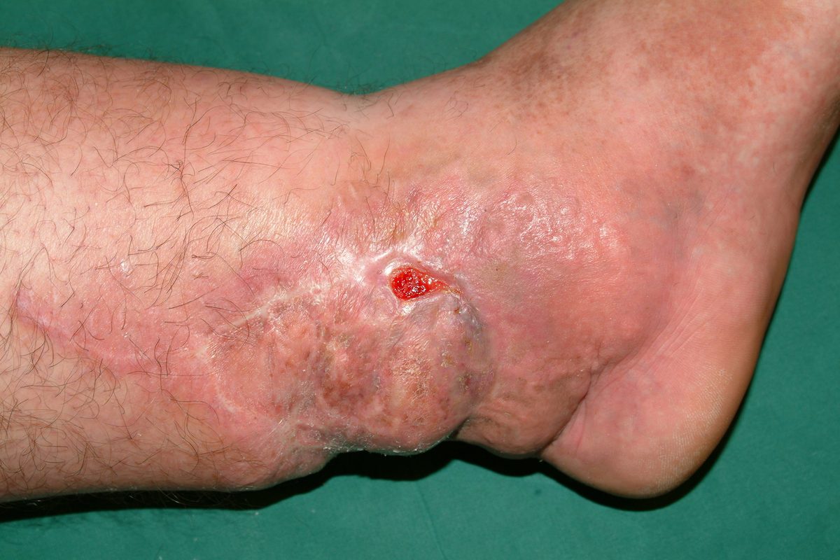 Klinische opname voor behandeling