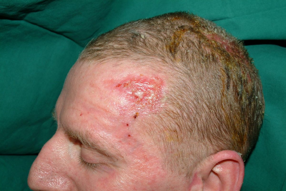 Klinische opname voor behandeling